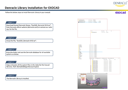 Denracle Library Installation for exocad